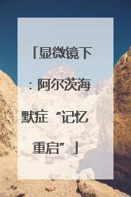显微镜下：阿尔茨海默症“记忆重启”